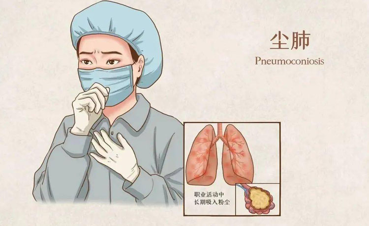 尘肺是怎么引起的