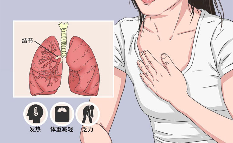 肺结节成因是什么