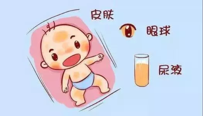 新生儿胆红素脑病的症状有哪些