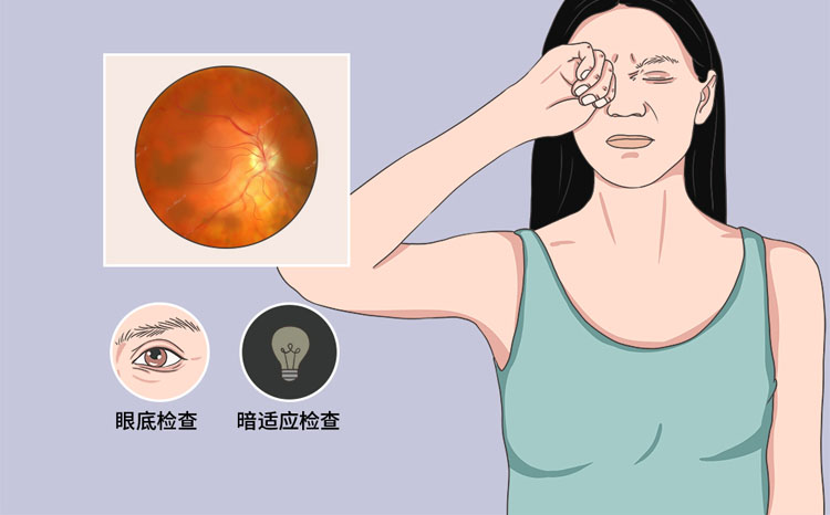 视网膜母细胞瘤的症状