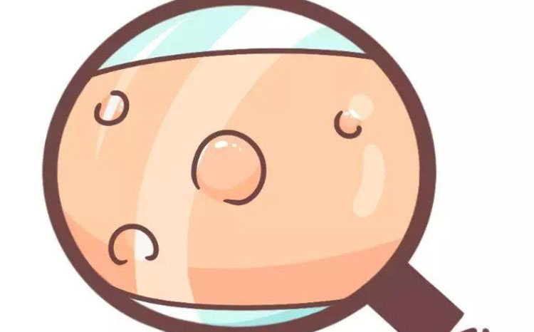 水痘可通过空气转播