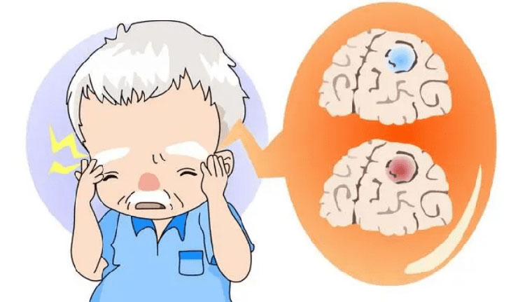 颞动脉炎的症状有哪些
