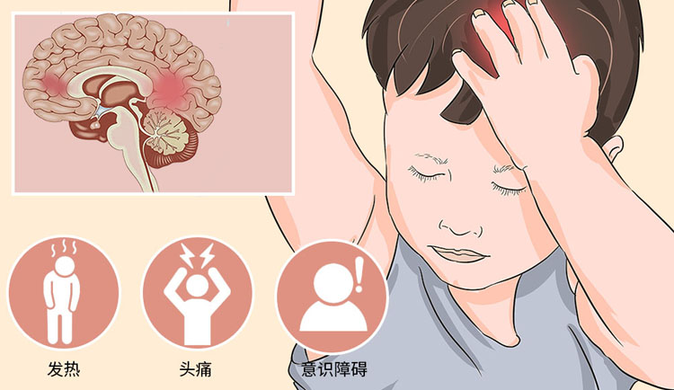 病毒性脑膜炎的症状有哪些