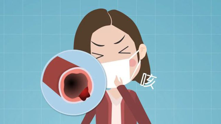 支气管扩张能根治吗