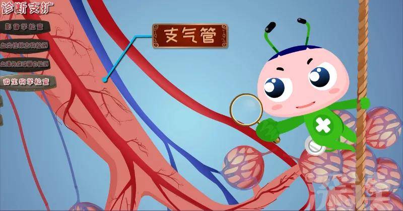 支气管扩张怎么办