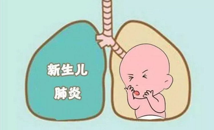 肺炎的症状有哪些