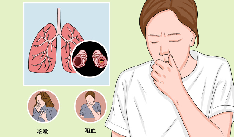 为什么支气管扩张不能根治