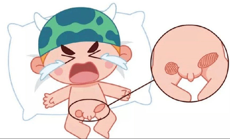 一岁宝宝疝气的症状