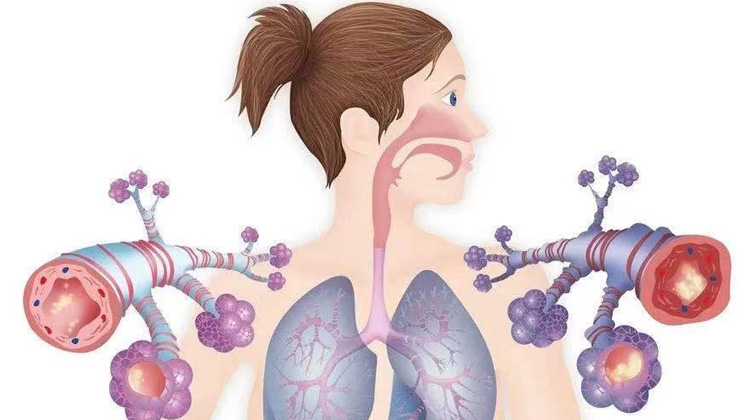 肺性脑病的症状有哪些