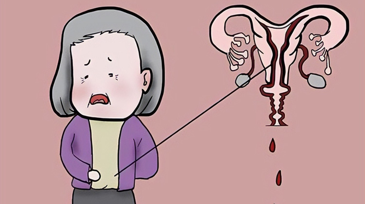 石女是咋回事