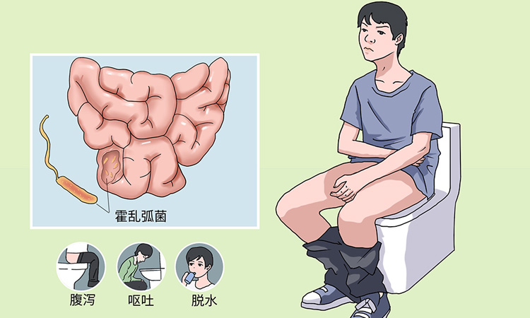 霍乱的症状有哪些