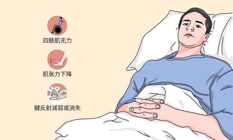 周期性麻痹的症状有哪些