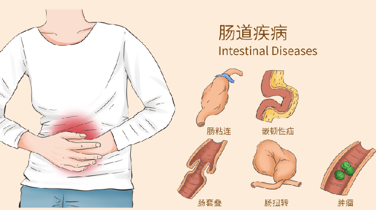 肠粘连的症状有哪些
