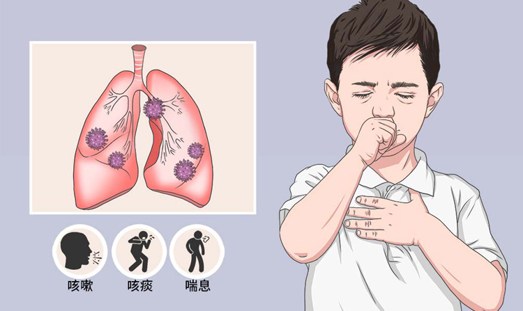 病毒性肺炎的检查项目有哪些