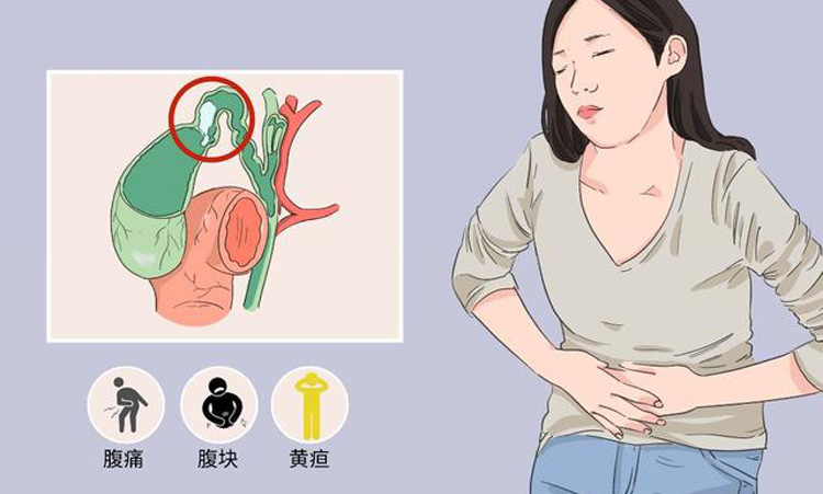 胆囊炎会引发什么疾病