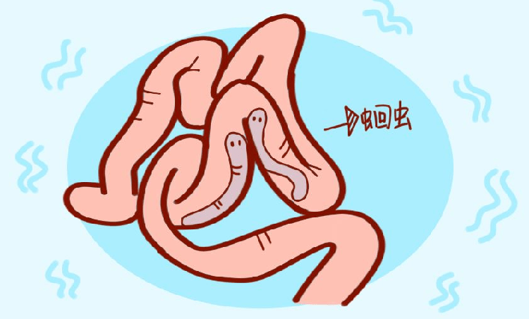 胆道蛔虫病是怎么引起的