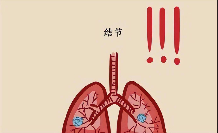 结节病的症状有哪些