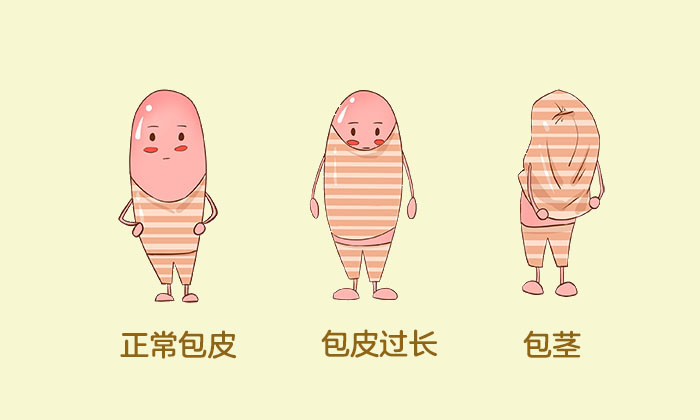 怎么才算包皮过长