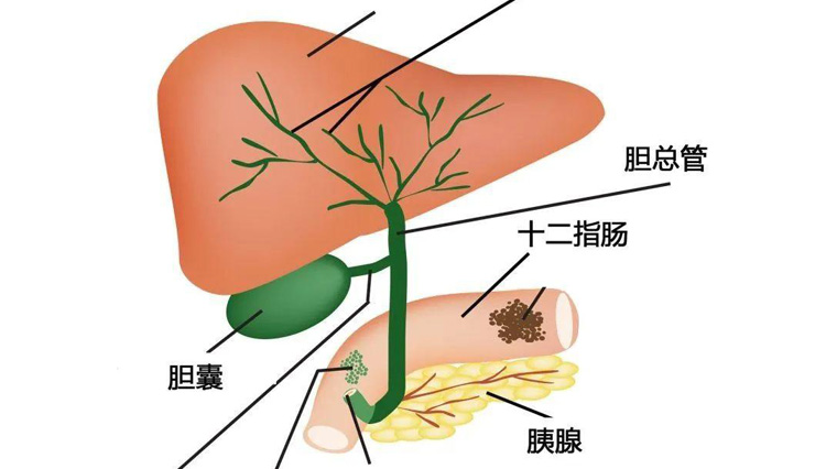 急性化脓性胆管炎的症状有哪些