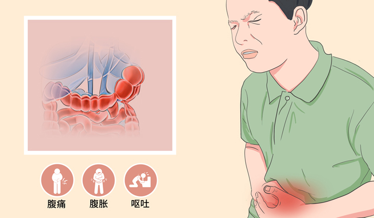麻痹性肠梗阻的症状有哪些