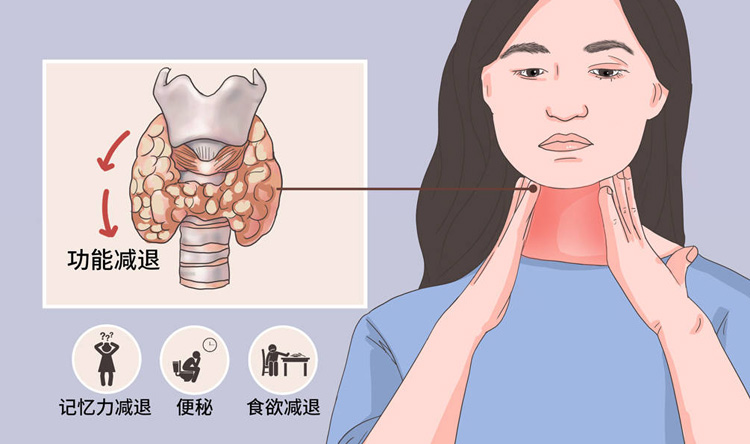 甲减有哪些症状