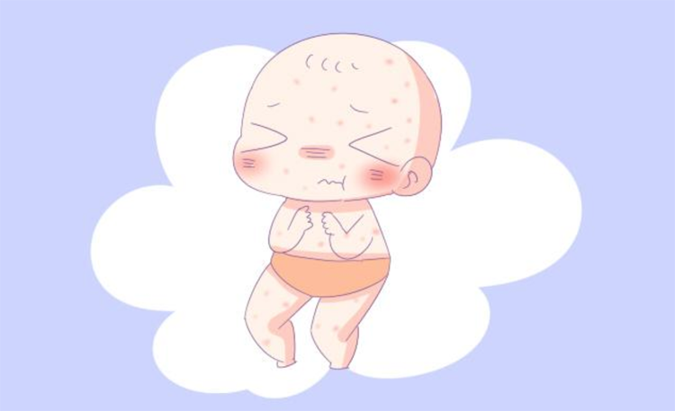 过敏之后要怎么做