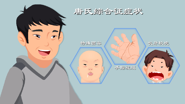 唐氏综合征的症状有哪些
