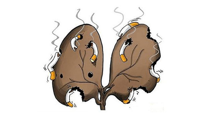 肺癌的早期症状有哪些