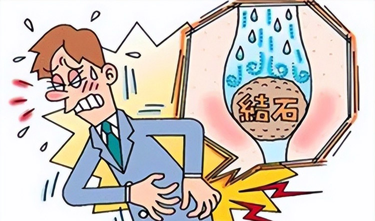 肾结石有哪些症状