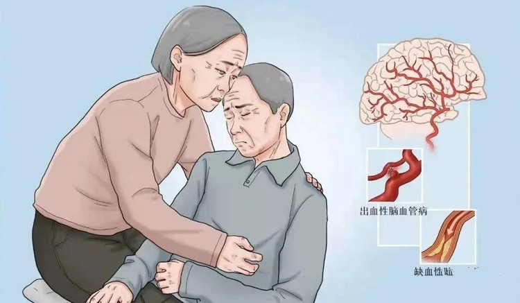 什么是中风