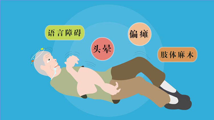 脑梗死有哪些症状