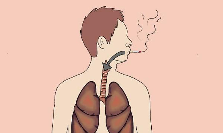 吸烟和不吸烟者所患的肺癌一样吗