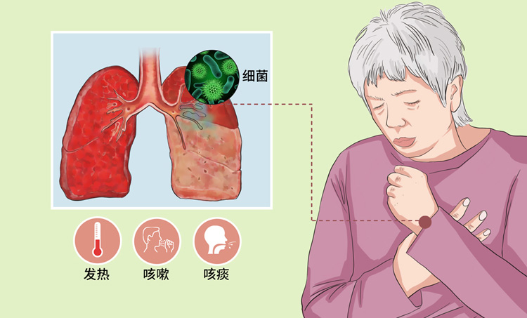 葡萄球菌肺炎有什么症状