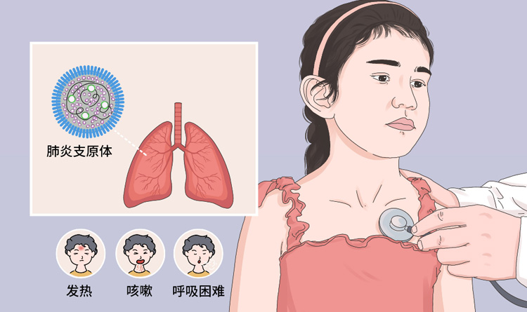 支原体肺炎有什么症状