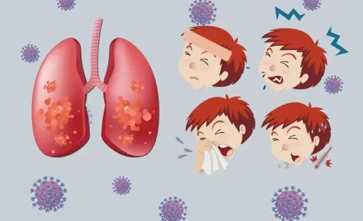 病毒性肺炎有什么症状