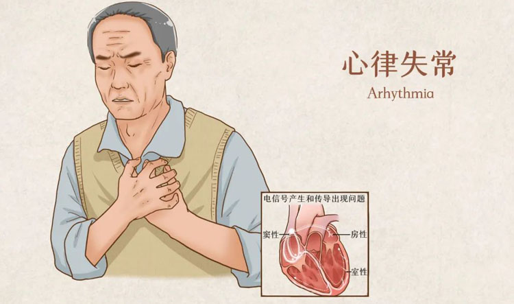 心律失常有什么症状