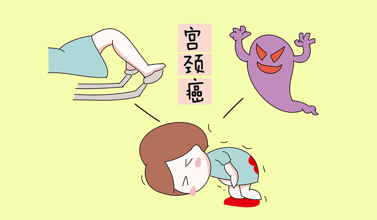 宫颈癌如何预防