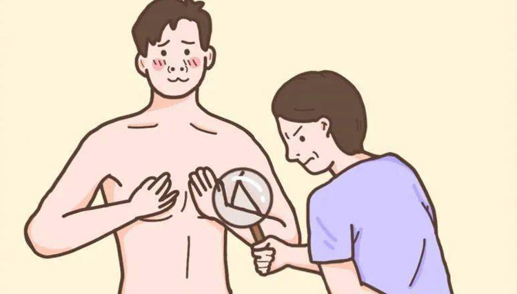 男性乳房肥大症是什么