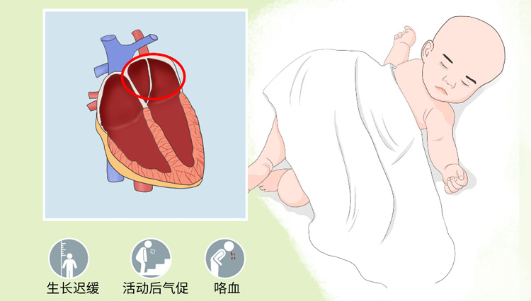三房心有什么症状
