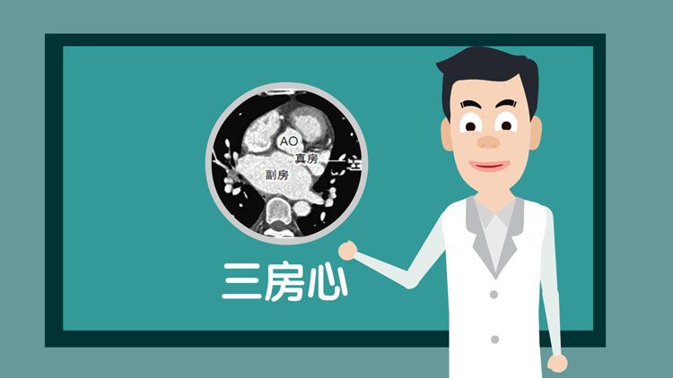 三房心是什么病