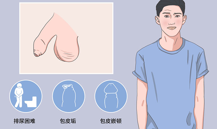 包茎过长有什么症状
