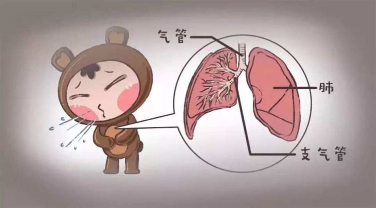 支气管肺炎如何治疗