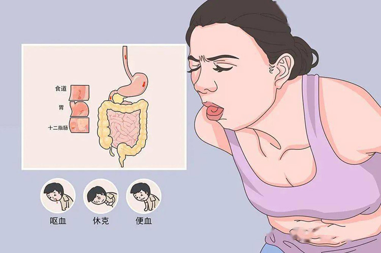 怎么区别呕血与咯血