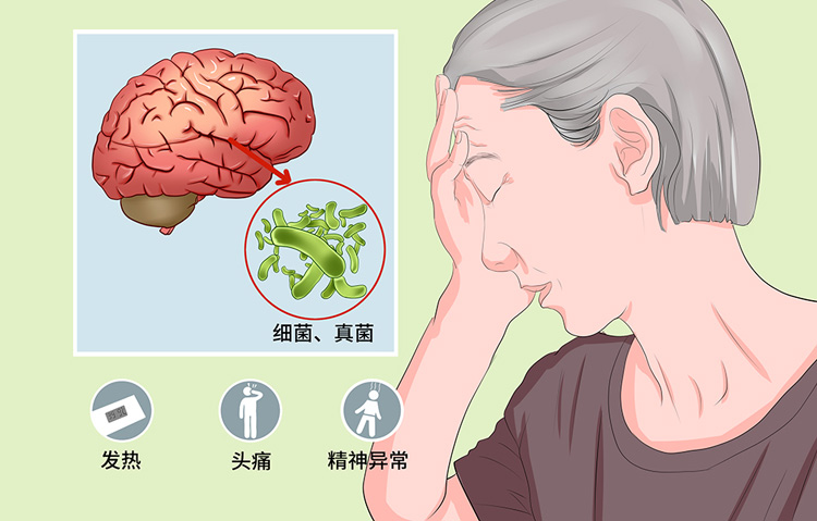 真菌性脑膜炎有哪些症状