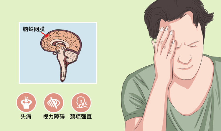 脑蛛网膜炎有什么症状