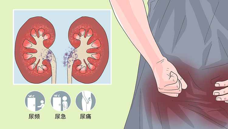 肾盂肾炎有哪些临床症状