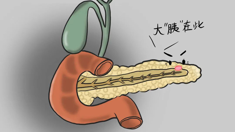 胰腺炎有哪些症状